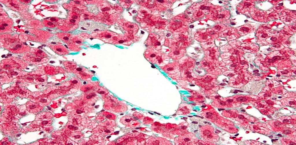 ¿qué Son Los Sinusoides Vasculares Definición Y Ejemplos Yubrainemk 2498